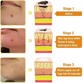 CREMA DE BOTOX VENENO DE ABEJA ANTI ARRUGAS